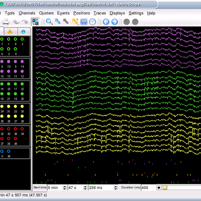 Neuro Scope NeuroScope - KDE Store